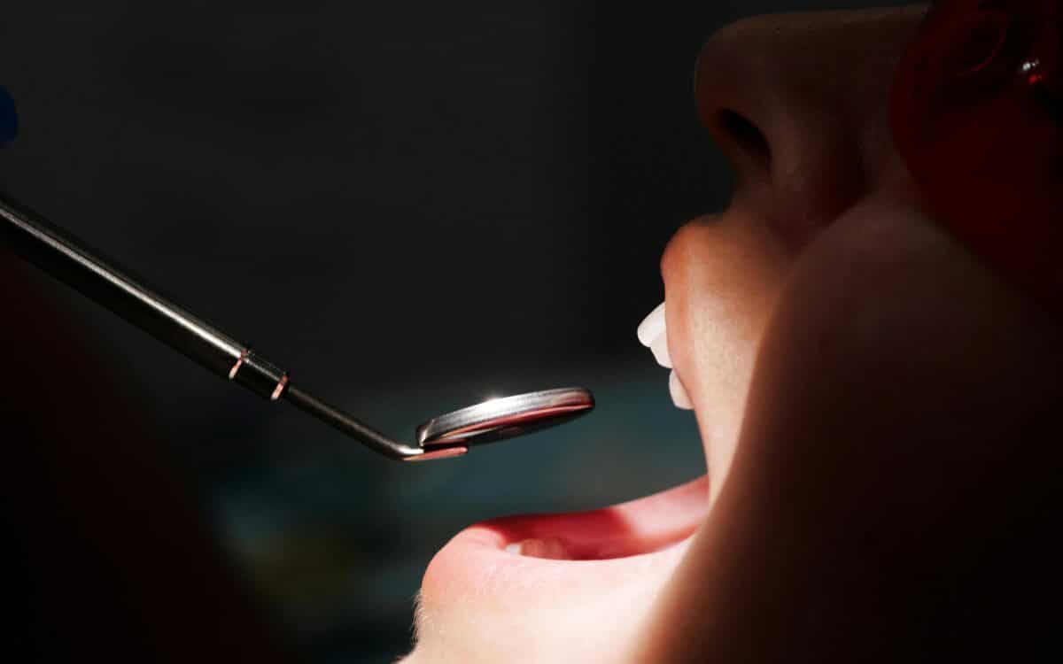 Detartraj și Periaj Profesional Craiova – Curățare Airflow | StomaArt