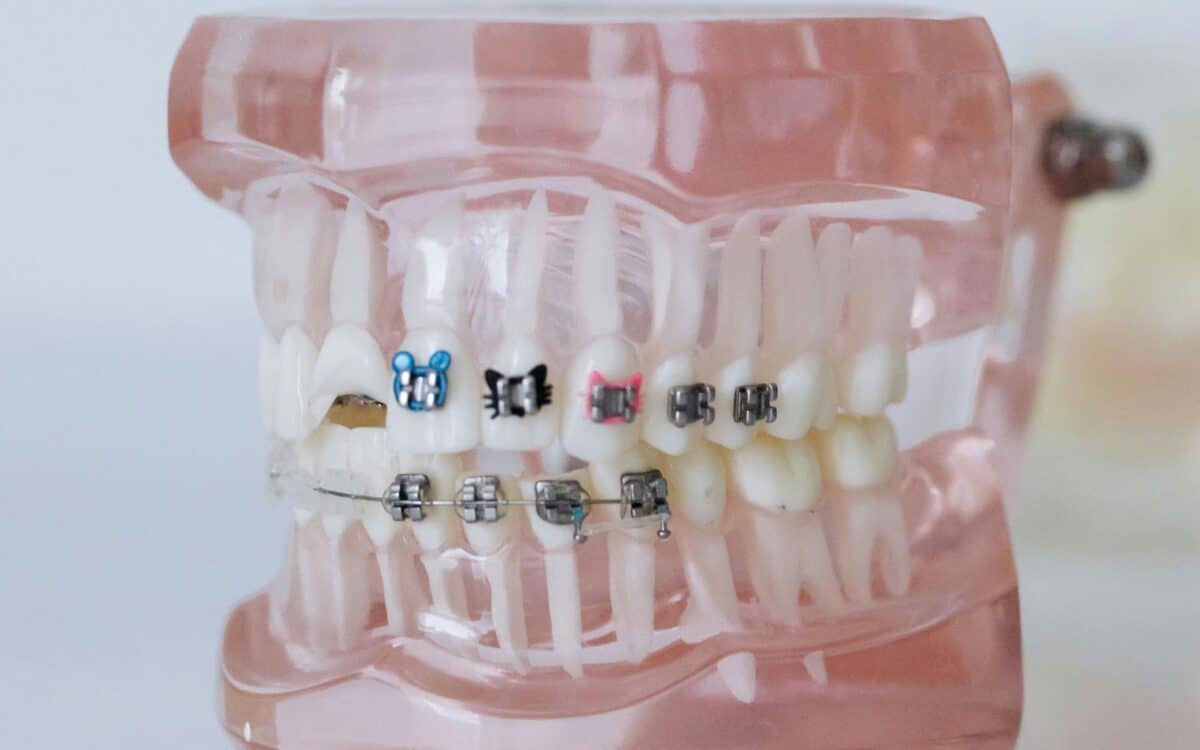 aparat dentar Craiova