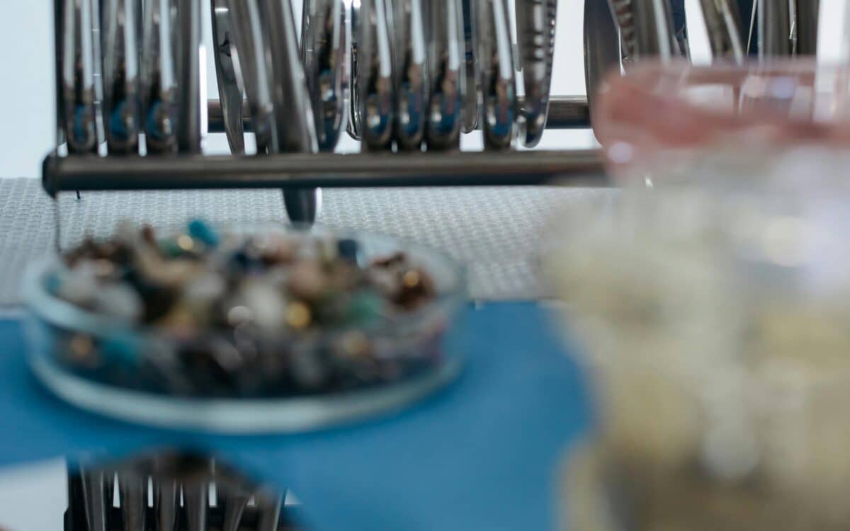 Extracții dentare Craiova – Proceduri sigure și fără durere | StomaArt