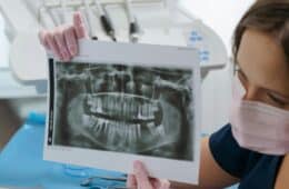 Plan de tratament stomatologic Craiova – De ce este esențial | StomaArt